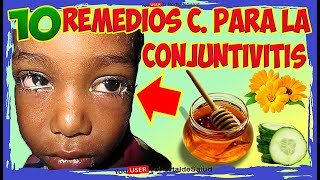 COMO CURAR LA CONJUNTIVITIS con 10 remedios caseros para la conjuntivitis [upl. by Neirad]