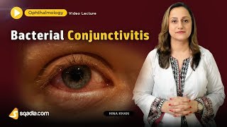 Bacterial Conjunctivitis  Ophthalmology Video Lecture  Medical Student VLearning [upl. by Ramedlav994]