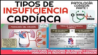 INSUFICIENCIA CARDÍACA DERECHA E IZQUIERDA FISIOPATOLOGÍA  GuiaMed [upl. by Edmonds686]