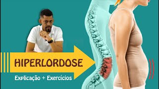 Hiperlordose  O que é  Vídeo c exercícios para a postura e para evitar a barriga pra frente [upl. by Arinaid]