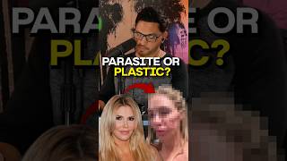 What Happened to Brandi Glanville’s Face [upl. by Allistir]