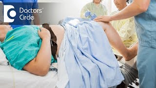 All about Uterine Inversion  Dr Teena S Thomas [upl. by Drapehs506]