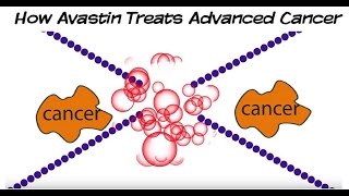 Use of Bevacizumab for Lung Cancer [upl. by Hadden384]