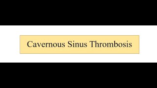 Cavernous Sinus Thrombosis [upl. by Duer]