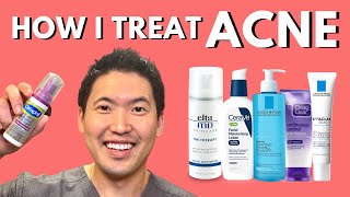 How I Treat Acne An Overview of Treatment Options [upl. by Fredek215]