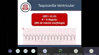 ACLS  Bradiarritmias Taquiarritmias y Paro Cardiorespiratorio [upl. by Eonak703]