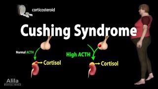 Cushing Syndrome Animation [upl. by Elokkin]