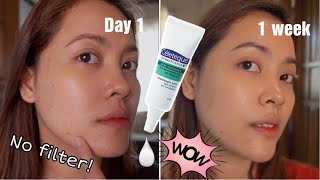 Cèleteque Acne Spot Corrector Gel Review [upl. by Bahner866]