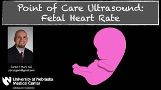 Fetal Echocardiography Explained  Dr Mahua Roy Bengali [upl. by Canale]