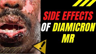 SIDE EFFECTS of DIAMICRON MR [upl. by Stochmal]