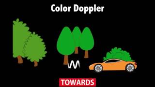 Ultrasound Physics Scanning Modes Color Doppler [upl. by Goldi384]