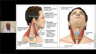 Neck lumps in general practice [upl. by Melissa976]