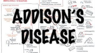 Addisons Disease  Overview clinical features pathophysiology investigations treatment [upl. by Suoirtemed92]