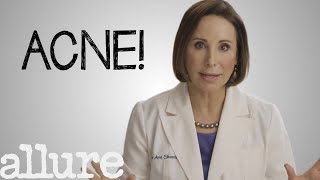 What is Acne and How Do I Get Rid of it Forever  Allure [upl. by Ellezaj]