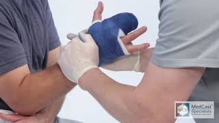 How to apply a RADIAL GUTTER Cast  Plus Cast Removal [upl. by Zohar514]