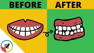 How To Make Your Teeth Crooked  2 UNSUSPECTED WAYS [upl. by Naahsar310]