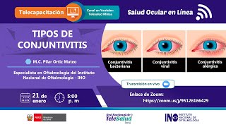 TIPOS DE CONJUNTIVITIS [upl. by Airotcivairam293]